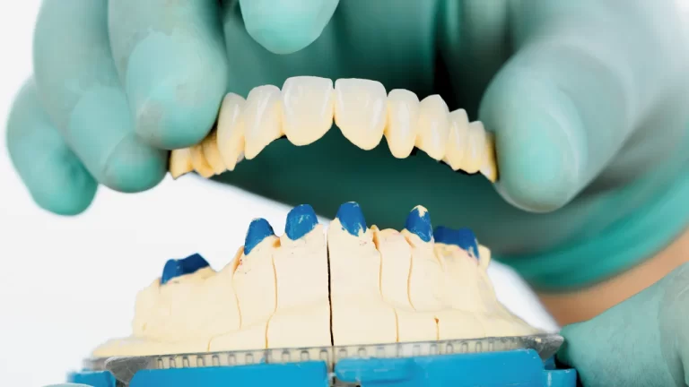 Dental bridges prop testing