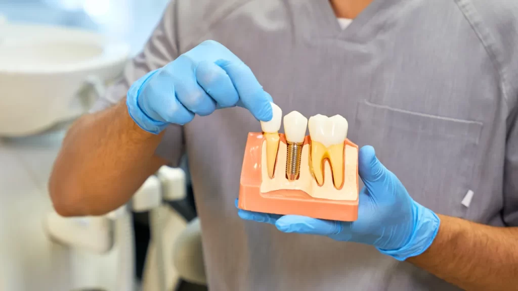 Dr holding a dental implant prop