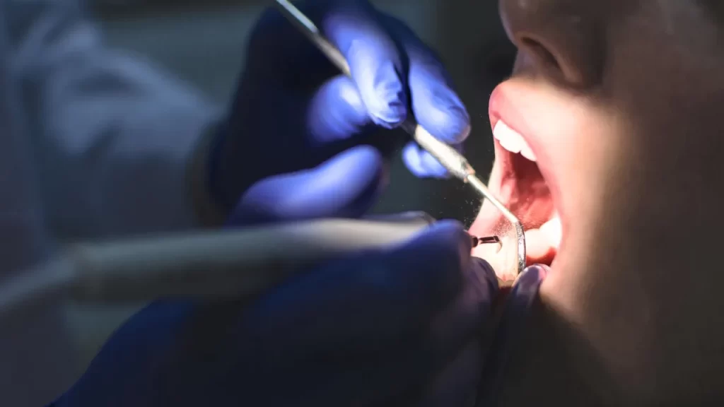 Close up teeth cleaning
