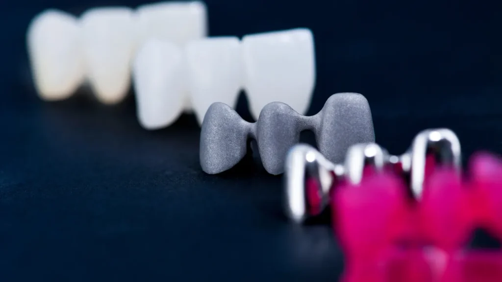Affordable Dental Bridges in Pretoria |  Restore Your Smile