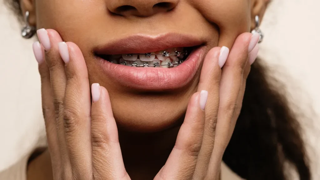 Braces Cost in Pretoria | Affordable Orthodontics