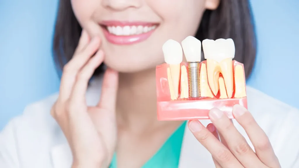Dental Implants Cost in Pretoria | Affordable Quality Care