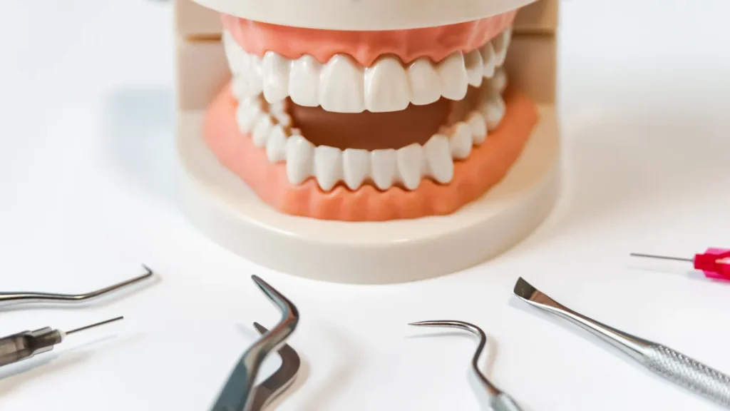 Periodontal Treatment Cost in Pretoria | Gum Care