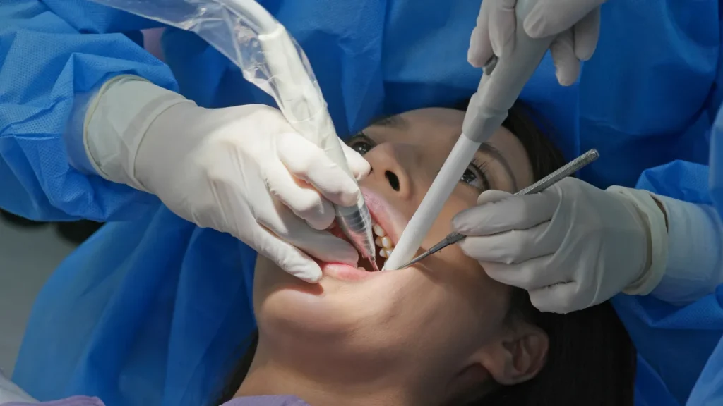 Root Canal Treatment Cost in Pretoria | Pain Relief